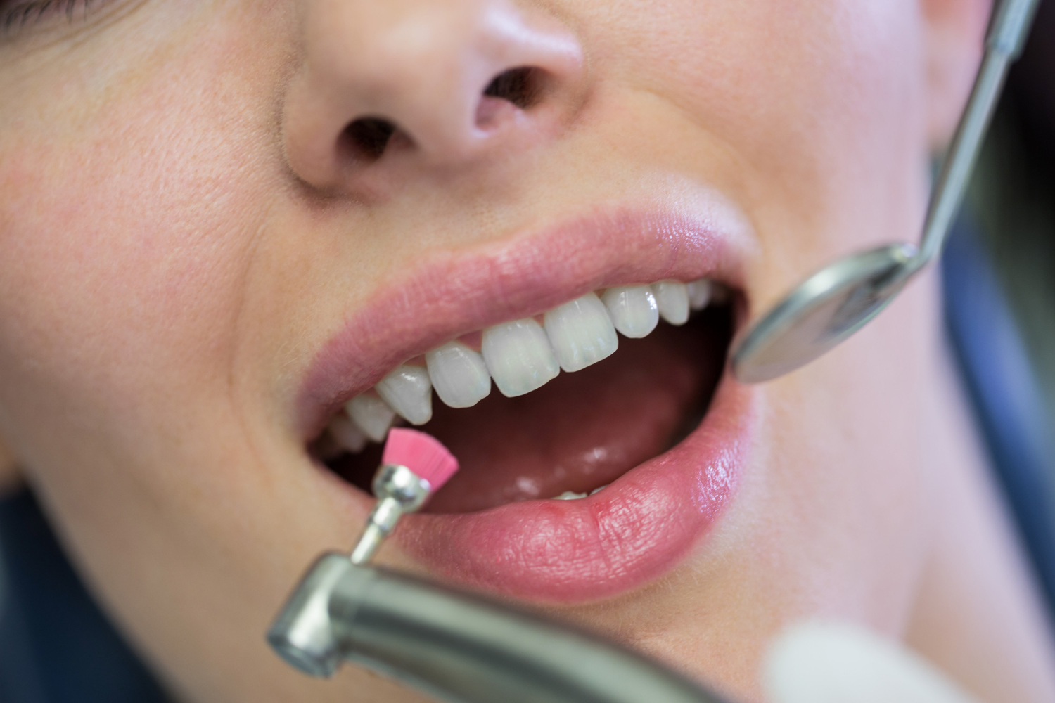 Dental Cleanings and Check-ups​