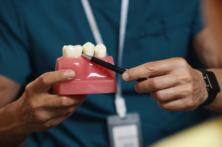 Dental Crowns
