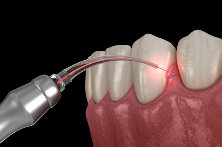 Oral Surgery